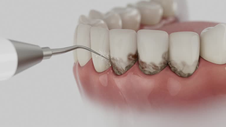 Reliable Dental Implants contractor in Trinity, FL by Smile Center Dentistry